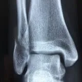 raccolta differenziata radiografie