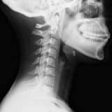 dove smaltire le radiografie 