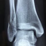 raccolta differenziata radiografie 